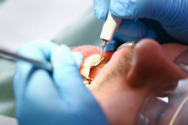 Best After-Hours Dental Care in Salado, TX