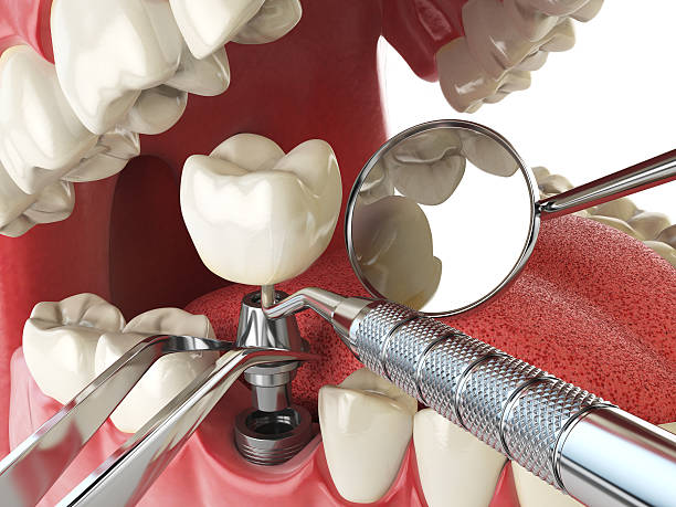Best Emergency Pediatric Dental Care in Salado, TX